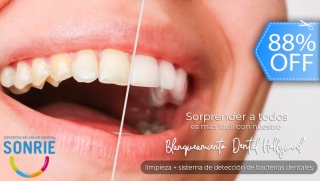 [Image: ¡Clínicas Sonríe! Blanqueamiento Dental ULTRA WHITE, Limpieza Ultrasónica Completa y Más.m]