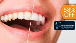 [Image: Blanqueamiento Dental Químico con Luz LED + Limpieza y Pulido Dentalm]