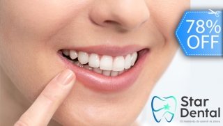 [Image: Blanqueamiento Dental LED, Limpieza con Ultrasonido, Eliminación de Manchas y Más.m]