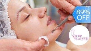 [Image: 2 Sesiones de Limpieza Facial: Microderm-Vacum + Radiofrecuencia + Extracción y Másm]