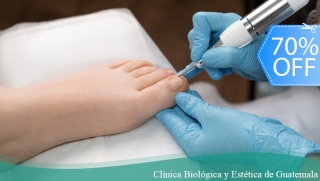 [Image: ¡Pedicure Clínico en Seco! Limpieza de Canales, Eliminacion de Callosidades, Recorte de Uñas y Más.m]