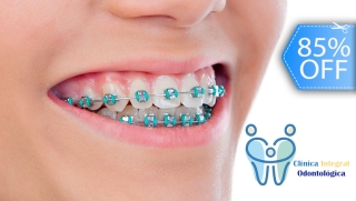 [Image: Colocación de Mini-Bracket Metálicos + Profilaxis Dental + Radiografía Panorámicam]