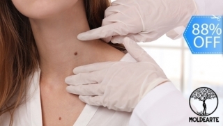 [Image: Cauterización Láser de hasta 20 Cabezas de Vena o Verrugas y Más.m]