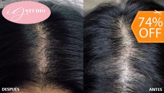 [Image: 1 Sesión de Microblading Capilar en el Área Frontal, Coronilla o Barba + Retoquem]