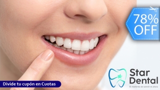 [Image: Blanqueamiento Dental Químico-LED, Limpieza con Ultrasonido, Remoción de Manchas y Más.m]