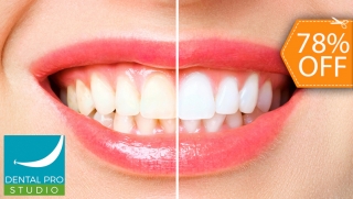 [Image: Blanqueamiento Dental con Luz LED + Limpieza Profunda + Consultam]
