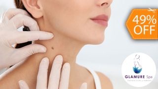 [Image: Electrocauterización de Hasta 20 Verrugasm]