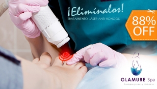 [Image: 1 Sesión Láser para 2 Uñas con Hongo + Evaluación Médicam]