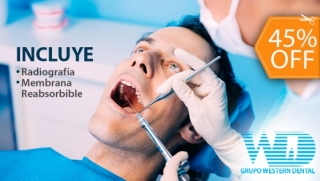 [Image: Cirugía o Extracción de Cordal + Radiografía + Membrana Reabsorbible + Consulta de Evaluación + Limpieza y Másm]