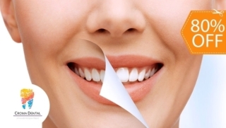 [Image: Blanqueamiento Dental con Luz LED + Limpieza Profunda con Ultrasonido + Consultam]