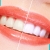 [Imagen:¡Paga $59 en Lugar de $195 por Blanqueamiento Dental Químico con Luz LED + Limpieza Manual + Profilaxis (Pulido Dental) + Consulta Odontológica!]