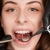 [Image: ¡Paga Q89 en Lugar de Q600 por Limpieza Dental Completa con Eliminación de Sarro y Placa con Ultrasonido + Pulido con Profijet + Aplicación Tópica de Flúor + Examen de Diagnóstico Completo y Evaluación!m]