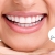 [Imagen:¡Paga $60 en Lugar de $155 por 2 Aplicaciones de Blanqueamiento Dental con Luz LED en 1 Sola Sesión + Limpieza Dental!]