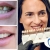 [Image: ¡Paga $60 en Lugar de $125 por Carilla Dental de Cerómero + Limpieza Dental con Ultrasonido!m]