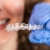 [Image: ¡Paga $18 en Lugar de $125 por Férula Dental + Limpieza Dental con Sistema de Succión con Aerosol + Aplicación Tópica de Flúor + Evaluación!m]