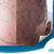[Imagen:¡Libérate de la Calvicie! ¡Paga $199 en vez de $900 por 3 Sesiones de Plasma Rico en Plaquetas para Alopecia!]