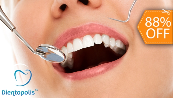 [Image: ¡Paga $25 en Lugar de $200 por Reconstrucción Mínimamente Invasiva de 4 Dientes Frontales + Consulta General + Revisión de Cordales + Limpieza dental + Aplicación Tópica de Flúor!m]