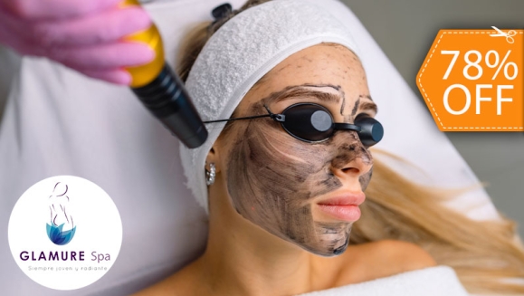 [Image: ¡Paga $19 en Vez de $85 por Novedoso Facial de Rejuvenecimiento “Hollywood Peel” con Microdermoabrasión con Punta de Diamante + Aplicación de Láser + Mascarilla de Carbón Activado + Extracción de Puntos Negros + Exfoliación + Hidratación y Más!m]