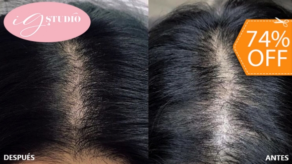 [Image: ¡Paga $65 en Lugar de $250 por Una Sesión de Microblading Capilar en el Área Frontal, Coronilla o Barba + Retoque!m]