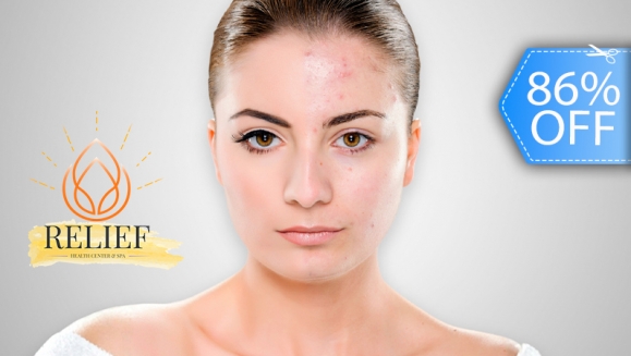 [Image: ¡Paga Q99 en Lugar de Q700 por Facial Antiacné con Extracción de Comedones + Alta Frecuencia + Mascarilla LED + Exfoliación + Vapor con Ozono + Limpieza Purificante + Tónico + Mascarilla Anti Acné + Arcilla Verde + Carbón Activado y Más!m]