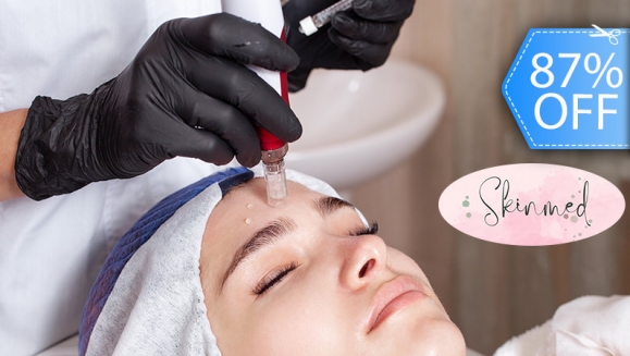 [Image: ¡Paga Q199 en Lugar de Q1,500 por Sesión de Dermapen con Cóctel de Ácido Hialurónico, Argireline y Vitaminas E y C!m]