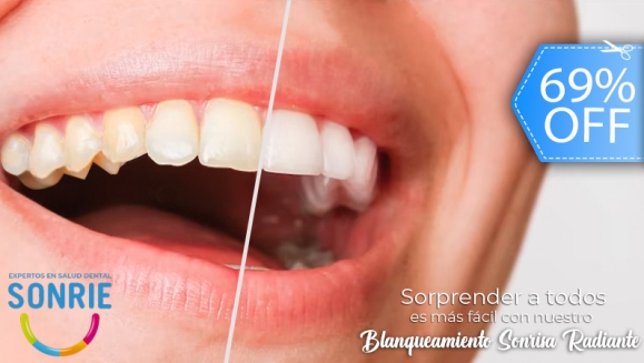 [Image: ¡Resultados Extraordinarios en tu Sonrisa! ¡Paga Q499 en Lugar de Q1,600 por Blanqueamiento Dental con Cambio de 1 a 2 Tonos +  Diagnóstico + Terapia Desensibilizante!m]