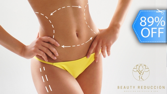 [Image: ¡Paga Q499 en Lugar de Q4,500 por Circuito Reductivo Intensivo en 4 Áreas: Abdomen, Laterales, Espalda Baja y Brazos: Mesoterapias, Masajes, Lipo Lasers, Ultracavitaciones, Vacumterapias y Más!m]