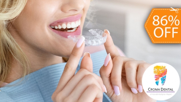 [Image: ¡Paga $18 en Lugar de $125 por Férula Dental para el Tratamiento del Rechinamiento de Dientes + Limpieza Dental con Sistema de Succión con Aerosol + Aplicación Tópica de Flúor + Evaluación!m]