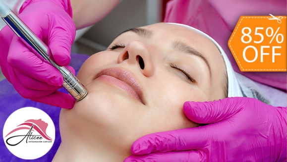 [Image: ¡Paga $20 en Lugar de $130 por 2 Sesiones de Limpieza Facial Profunda con: 2 Microdermoabrasiones con Punta de Diamante + 2 Altas Frecuencias + 2 Limpiezas Faciales con Extracción de Puntos Negros + 2 Sesiones de Vapor de Ozono y Más!m]