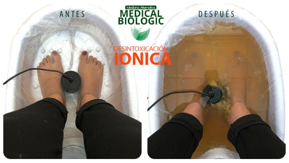 [Image: ¡Paga $10 en Lugar de $20 por 2 Sesiones de Desintoxicación Iónica + Análisis de Resultados!m]