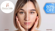 [Imagen:¡Paga Q75 en Lugar de Q380 por 1 Sesión de Láser IPL para Manchas con: Peeling Químico + IPL + Mascarilla + Cabina LED + Aplicación de Vitamina C + Aplicación de Retinol + Aplicación de Crema para Manchas y Protector Solar!]