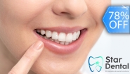 [Image: ¡Paga Q395 en Lugar de Q1,800 por Blanqueamiento Dental Químico con Luz LED + Remoción de Manchas con Profilaxis + Limpieza con Ultrasonido + Aplicación de Flúor + Evaluación Completa con Cámara Intraoral!m]