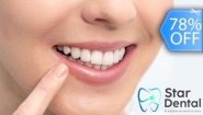 [Image: ¡Paga Q395 en Lugar de Q1,800 por Blanqueamiento Dental Químico con Luz LED + Remoción de Manchas con Profilaxis + Limpieza con Ultrasonido + Aplicación de Flúor + Evaluación Completa con Cámara Intraoral!m]