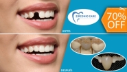 [Image: ¡Paga $80 en Lugar de $265 por 1 Pieza Dental de Zirconio, Resina y Porcelana (Sin Metales) + Limpieza Dental con Ultrasonido + 2 Sellantes + Evaluación de Cordales + Certificado de $10!m]