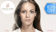 [Image: ¡Paga Q75 en Lugar de Q450 por Rejuvenecimiento Facial que Incluye: 1 Láser IPL + 1 Limpieza Facial + 1 Aplicación de Serum de Retinol + 1 Aplicación de Vitamina C + 1 Aplicación de Filtro Solar!m]