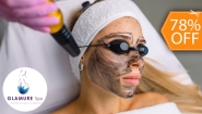[Image: ¡Paga $19 en Vez de $85 por Novedoso Facial de Rejuvenecimiento “Hollywood Peel” con Microdermoabrasión con Punta de Diamante + Aplicación de Láser + Mascarilla de Carbón Activado + Extracción de Puntos Negros + Exfoliación + Hidratación y Más!m]