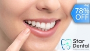 [Image: ¡Paga Q395 en Lugar de Q1,800 por Blanqueamiento Dental Químico con Luz LED + Remoción de Manchas con Profilaxis + Limpieza con Ultrasonido +  Evaluación Completa con Cámara Intraoral!m]