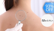 [Image: ¡Paga Q75 en Lugar de Q1,100 por Cauterización Láser de Hasta 20 Cabezas de Vena, 4 Lunares o 4 Verrugas (de hasta 5 mm) + Evaluación Médica!m]
